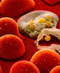 Haber | Eşcinsel erkekler arasında HIV artıyor 